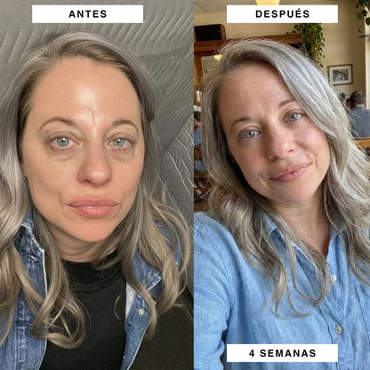 Parches Quiero Glow™ - Reduce Ojeras